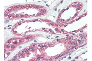 Human Kidney (formalin-fixed, paraffin-embedded) stained with ARHGEF17at 5 µg/ml followed by biotinylated goat anti-rabbit IgG secondary antibody, alkaline phosphatase-streptavidin and chromogen. (ARHGEF17 anticorps)