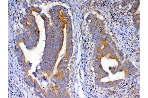 IHC analysis of NSF using anti-NSF antibody .