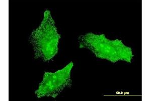Immunofluorescence of monoclonal antibody to MKI67 on HeLa cell.
