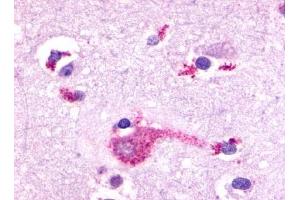 Immunohistochemical staining of Brain (Neurons and glia) using anti- GRM2 antibody ABIN122313 (GRM2 anticorps  (N-Term))