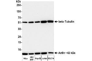 Western Blotting (WB) image for anti-Tubulin, beta (TUBB) (AA 1-50) antibody (ABIN7453995) (Recombinant TUBB anticorps  (AA 1-50))