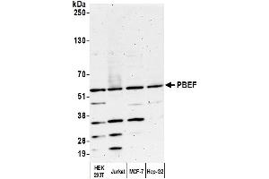 Western Blotting (WB) image for anti-Nicotinamide phosphoribosyltransferase (NAMPT) (AA 400-450) antibody (ABIN7454619) (NAMPT anticorps  (AA 400-450))