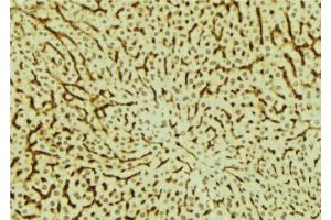ABIN6279527 at 1/100 staining Mouse liver tissue by IHC-P. (MED28 anticorps  (Internal Region))