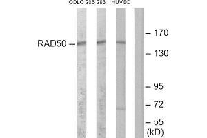 Western Blotting (WB) image for anti-RAD50 Homolog (S. Cerevisiae) (RAD50) (Internal Region) antibody (ABIN1850502) (RAD50 anticorps  (Internal Region))