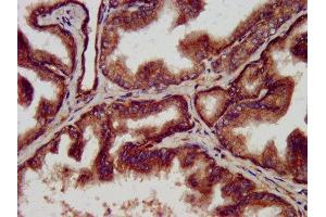 IHC image of ABIN7144958 diluted at 1:500 and staining in paraffin-embedded human prostate tissue performed on a Leica BondTM system. (CLPP anticorps  (AA 223-277))