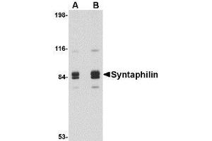Image no. 1 for anti-Syntaphilin (SNPH) (Internal Region) antibody (ABIN1493822) (Syntaphilin anticorps  (Internal Region))