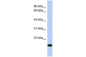 ARL17 antibody used at 1 ug/ml to detect target protein. (ARL17 anticorps  (Middle Region))