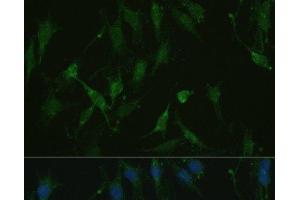 Immunofluorescence analysis of C6 cells using TRPV1 Polyclonal Antibody at dilution of 1:100. (TRPV1 anticorps)