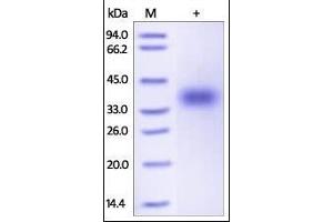Human CD47, His Tag on SDS-PAGE under reducing (R) condition. (CD47 Protein (CD47) (AA 19-139) (His tag))