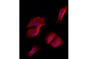 ABIN6263011 and ABIN6273265 staining Hela by IF/ICC. (LRPPRC anticorps  (Internal Region))