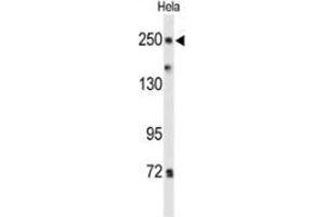 Western blot analysis of PTPRD(arrow) in Hela cell line lysates (35ug/lane) using PTPRD  Antibody  (N-term). (PTPRD anticorps  (N-Term))