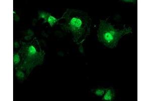 Immunofluorescence (IF) image for anti-Aryl Hydrocarbon Receptor Interacting Protein-Like 1 (AIPL1) antibody (ABIN1496509)