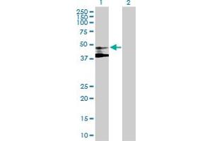 Western Blot analysis of ST3GAL3 expression in transfected 293T cell line by ST3GAL3 MaxPab polyclonal antibody. (ST3GAL3 anticorps  (AA 1-390))