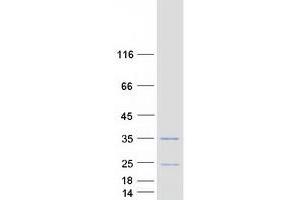 Validation with Western Blot