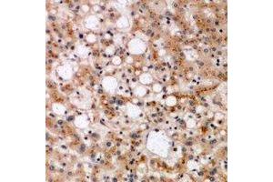 anti-ER Lipid Raft Associated 1 (ERLIN1) antibody