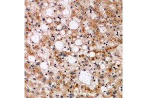 Immunohistochemical analysis of SPFH1 staining in human liver formalin fixed paraffin embedded tissue section. (ERLIN1 anticorps)