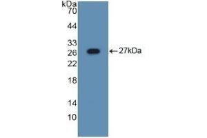 Detection of Recombinant ASGR1, Mouse using Polyclonal Antibody to Asialoglycoprotein Receptor 1 (ASGR1) (Asialoglycoprotein Receptor 1 anticorps  (AA 80-281))