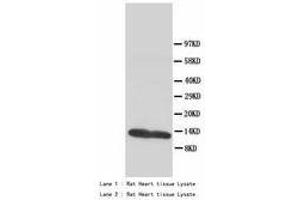 Image no. 2 for anti-Fatty Acid Binding Protein 3, Muscle and Heart (FABP3) (AA 119-133) antibody (ABIN1493379)