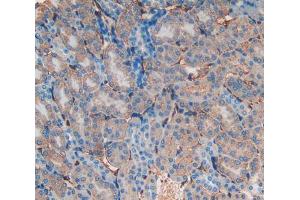 Used in DAB staining on fromalin fixed paraffin- embedded kidney tissue