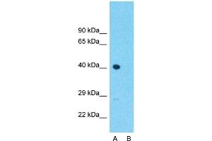 Host:  Rabbit  Target Name:  ATOH1  Sample Type:  Placenta  Lane A:  Primary Antibody  Lane B:  Primary Antibody + Blocking Peptide  Primary Antibody Concentration:  1ug/ml  Peptide Concentration:  5ug/ml  Lysate Quantity:  25ug/lane  Gel Concentration:  0.