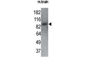 Western Blotting (WB) image for anti-MAP/microtubule Affinity-Regulating Kinase 1 (MARK1) antibody (ABIN2995250) (MARK1 anticorps)