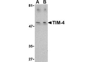 Image no. 1 for anti-T-Cell Immunoglobulin and Mucin Domain Containing 4 (TIMD4) (C-Term) antibody (ABIN318767) (TIMD4 anticorps  (C-Term))