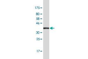 Western Blot detection against Immunogen (37. (LRGUK anticorps  (AA 721-825))