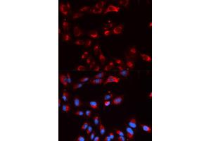 Immunofluorescence (IF) image for anti-Complement Factor P (CFP) antibody (ABIN1876586) (CFP anticorps)