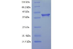SDS-PAGE (SDS) image for ER Membrane Protein Complex Subunit 9 (EMC9) (AA 1-208), (full length) protein (His-SUMO Tag) (ABIN5712017)