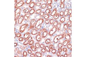 Immunohistochemistry of paraffin-embedded rat kidney using SHMT1 antibody (ABIN6132654, ABIN6147744, ABIN6147746 and ABIN6216135) at dilution of 1:100 (40x lens).
