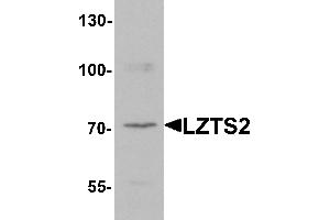 Western blot analysis of LZTS2 in human kidney tissue lysate with LZTS2 antibody at 1 µg/mL. (LZTS2 anticorps  (N-Term))
