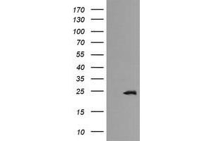 Image no. 1 for anti-RAB21, Member RAS Oncogene Family (RAB21) antibody (ABIN1500548) (RAB21 anticorps)