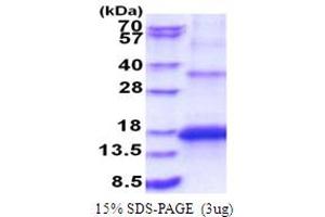 SDS-PAGE (SDS) image for Potassium Large Conductance Calcium-Activated Channel, Subfamily M beta Member 3 (KCNMB3) (AA 82-207) protein (His tag) (ABIN5853863)
