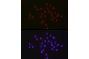 Immunofluorescence analysis of PC-12 cells using USP39 Rabbit mAb (ABIN7271160) at dilution of 1:100 (40x lens).