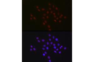 Immunofluorescence analysis of PC-12 cells using USP39 Rabbit mAb (ABIN7271160) at dilution of 1:100 (40x lens). (USP39 anticorps)