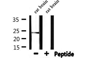 Western blot analysis of extracts from rat brain, using HSPB2 Antibody. (HSPB2 anticorps  (Internal Region))
