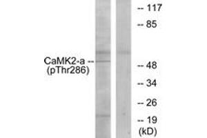 Western blot analysis of extracts from K562 cells, using CaMK2 (Phospho-Thr286) Antibody. (CAMK2B anticorps  (pThr286))
