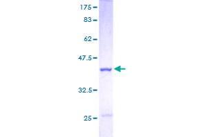 Image no. 1 for Cystatin B (Stefin B) (CSTB) (AA 1-98) protein (GST tag) (ABIN1350601)