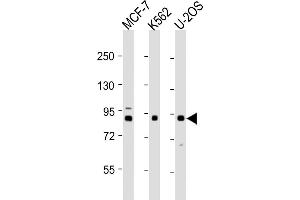 All lanes : Anti-PLOD1 Antibody (N-term) at 1:1000-1:2000 dilution Lane 1: MCF-7 whole cell lysates Lane 2: K562 whole cell lysates Lane 3: U-2OS whole cell lysates Lysates/proteins at 20 μg per lane. (PLOD1 anticorps  (N-Term))
