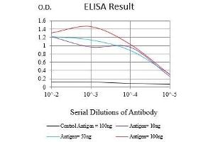 Black line: Control Antigen (100 ng),Purple line: Antigen (10 ng), Blue line: Antigen (50 ng), Red line:Antigen (100 ng)