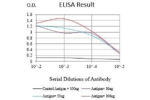 Black line: Control Antigen (100 ng),Purple line: Antigen (10 ng), Blue line: Antigen (50 ng), Red line:Antigen (100 ng) (KRT6A anticorps  (AA 253-352))