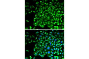 Immunofluorescence analysis of U2OS cells using TNFRSF1B antibody (ABIN5970147). (TNFRSF1B anticorps)