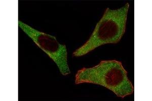 Fluorescent image of HeLa cells stained with CDK4 antibody at 1:25. (CDK4 anticorps  (AA 273-305))