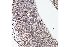 Immunohistochemistry of paraffin-embedded mouse fetal Brain using TET1 Rabbit pAb (ABIN3022030, ABIN3022031, ABIN3022032, ABIN1513597 and ABIN6218576) at dilution of 1:50 (40x lens). (TET1 anticorps)