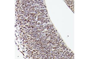 Immunohistochemistry of paraffin-embedded mouse fetal Brain using TET1 Rabbit pAb (ABIN3022030, ABIN3022031, ABIN3022032, ABIN1513597 and ABIN6218576) at dilution of 1:50 (40x lens).