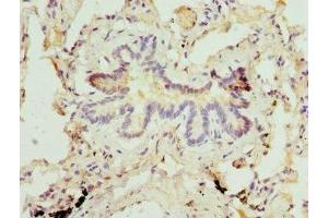 Immunohistochemistry of paraffin-embedded human lung tissue using ABIN7159380 at dilution of 1:100