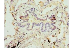 Immunohistochemistry of paraffin-embedded human lung tissue using ABIN7159380 at dilution of 1:100 (MBTPS1 anticorps  (AA 803-1052))
