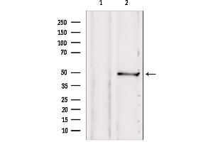 Western blot analysis of extracts from 293, using SUCLA2 antibody. (SUCLA2 anticorps  (Internal Region))