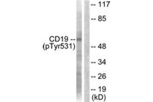 Western blot analysis of extracts from COS7 cells treated with Serum 10% 30', using CD19 (Phospho-Tyr531) Antibody. (CD19 anticorps  (pTyr531))