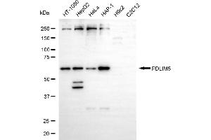 Western blotting analysis using PDLIM5 antibody (ABIN7799749).